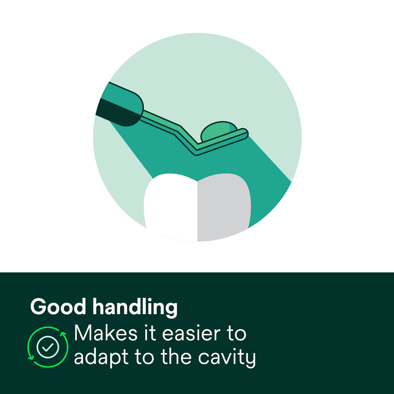 (2) Filtek Z250 XT Nano Hybrid: Good handling