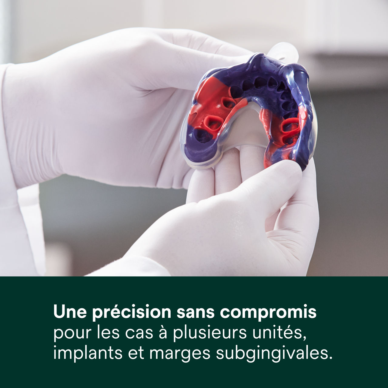 (1) Impregum™ - Une précision sans compromis