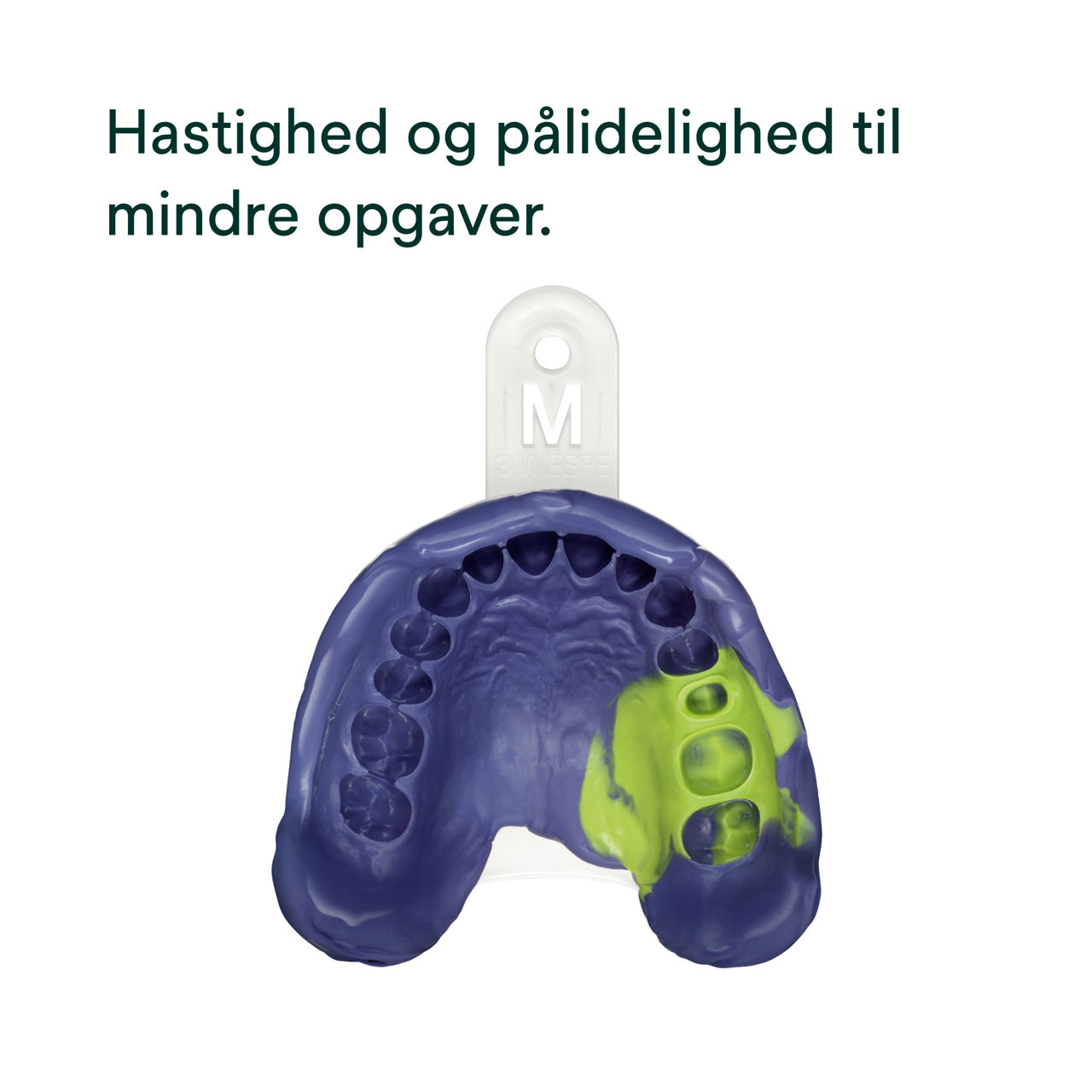 (2) Impregum™ Super Quick polyæteraftryksmateriale: Hastighed og pålidelighed til mindre opgaver.