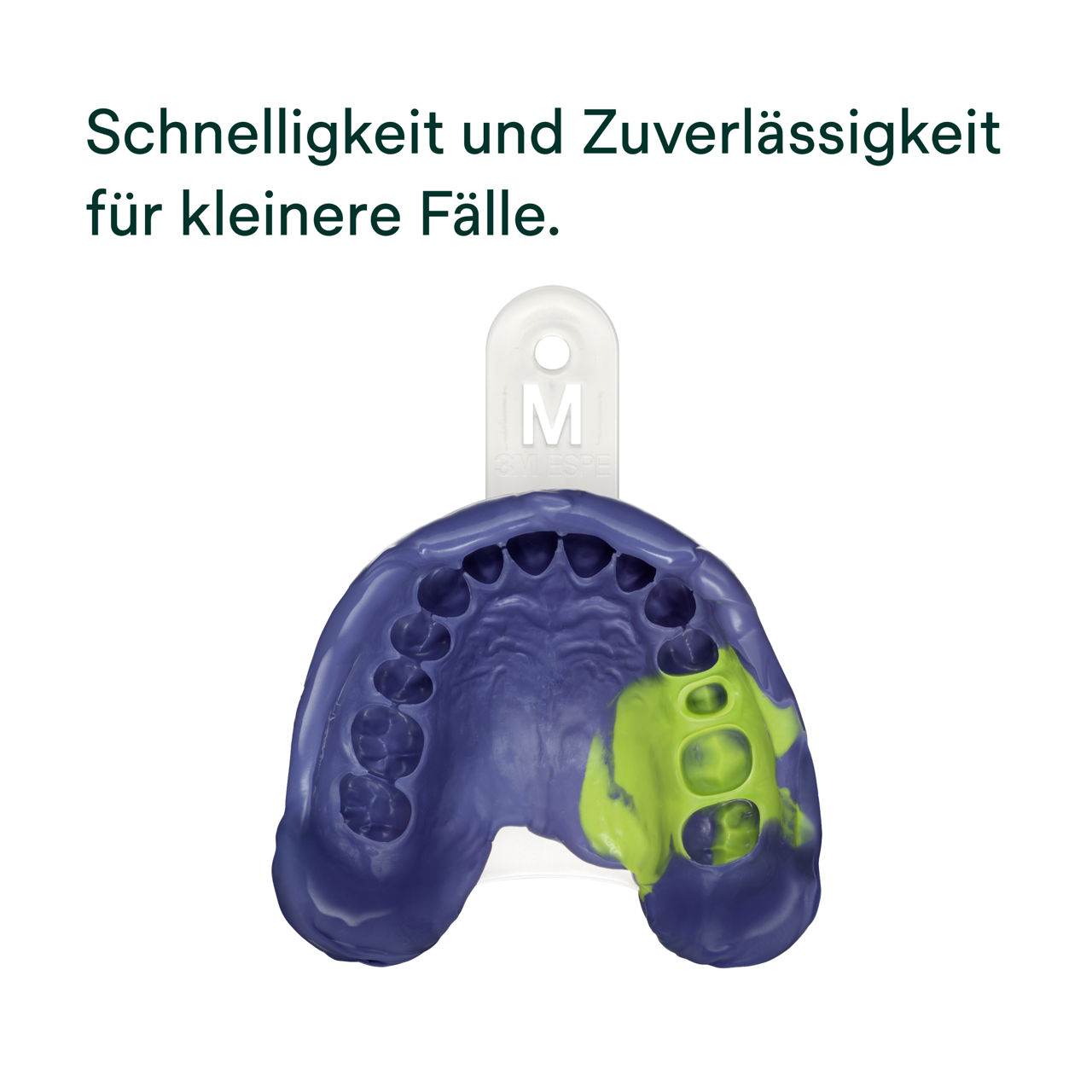 (2) Impregum™ Super Quick Abformmaterialien: Schnelligkeit und Zuverlässigkeit