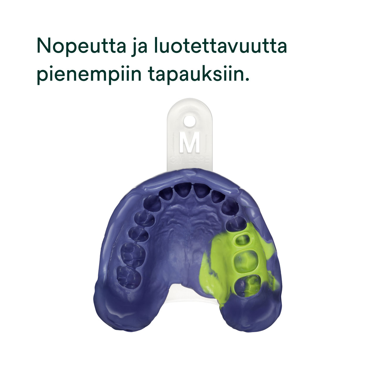 (2) Impregum™ Super Quick -polyeetterijäljennösaine : Nopeutta