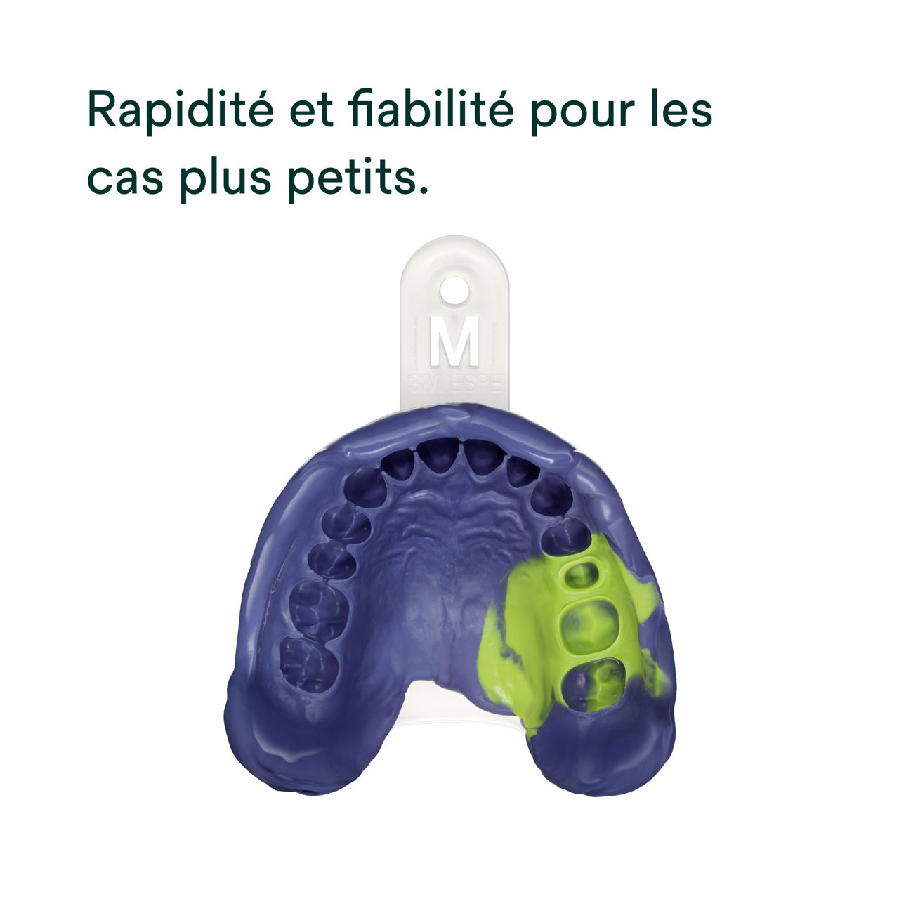 (2) Matériau d'empreinte polyéther Impregum™ Super Quick: Rapidité et fiabilité