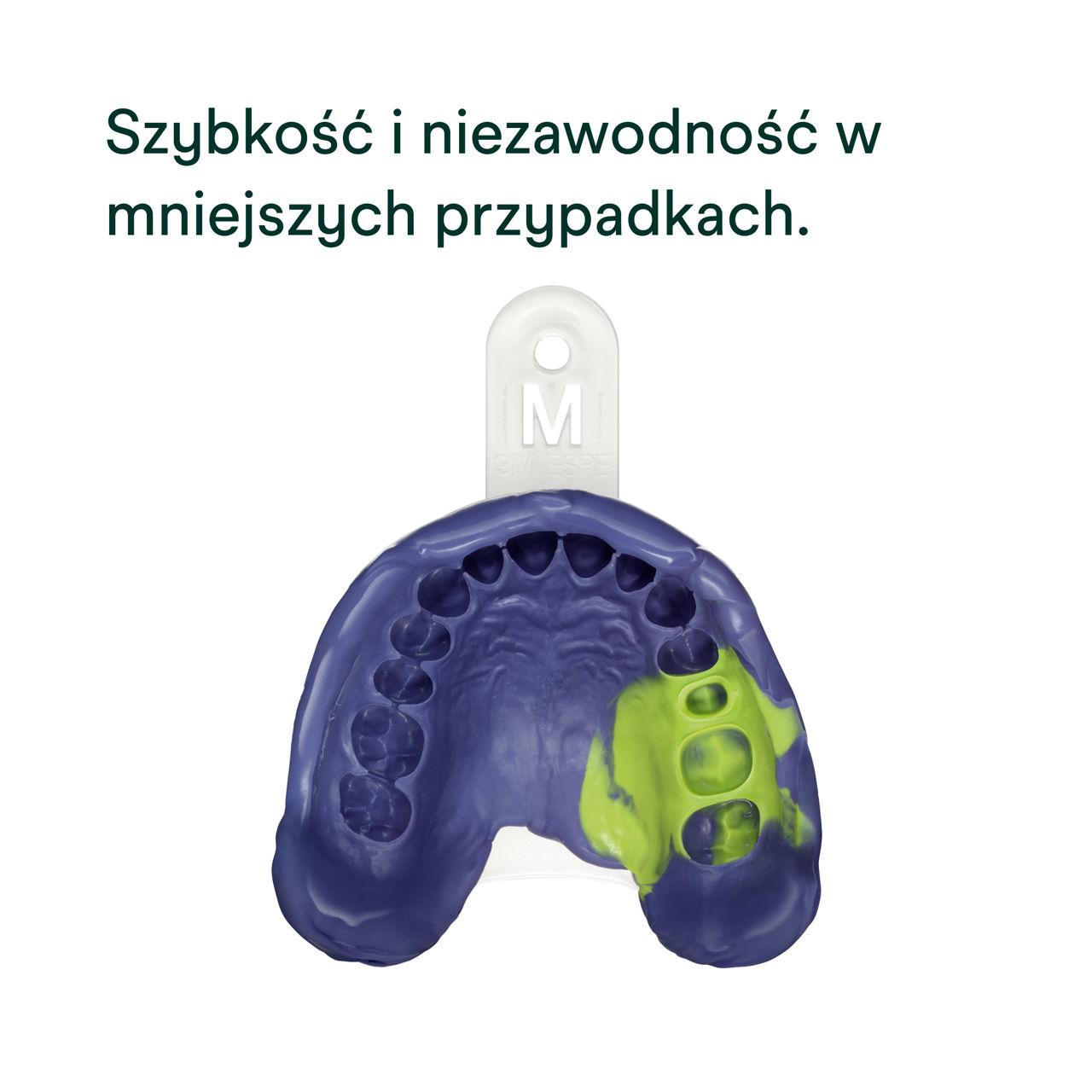 (2) Impregum™ Super Quick - Polieterowa masa do pobierania wycisków: Szybkość i niezawodność