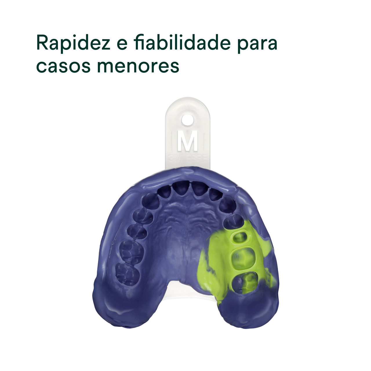 (2) Material de Impressão de Poliéter Impregum™ Super Quick: Rapidez e fiabilidade