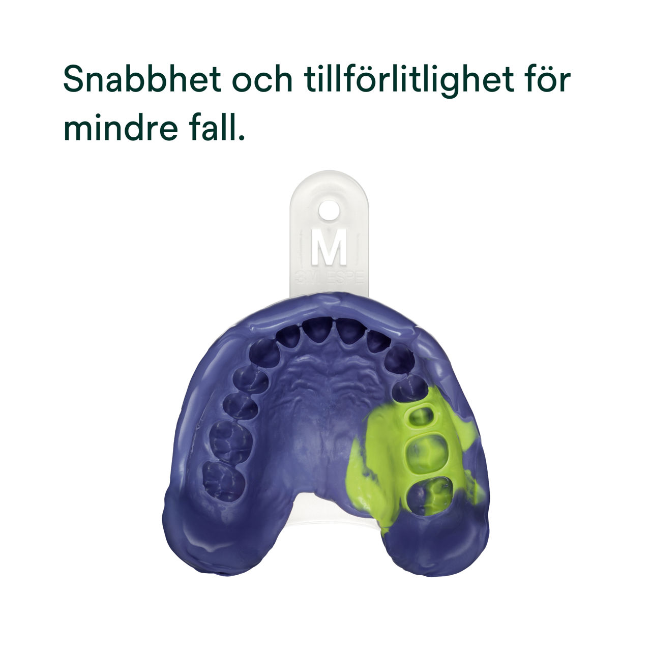 (2) Impregum™ Super Quick polyeter avtrycksmaterial: Snabbhet och tillförlitlighet för mindre fall.
