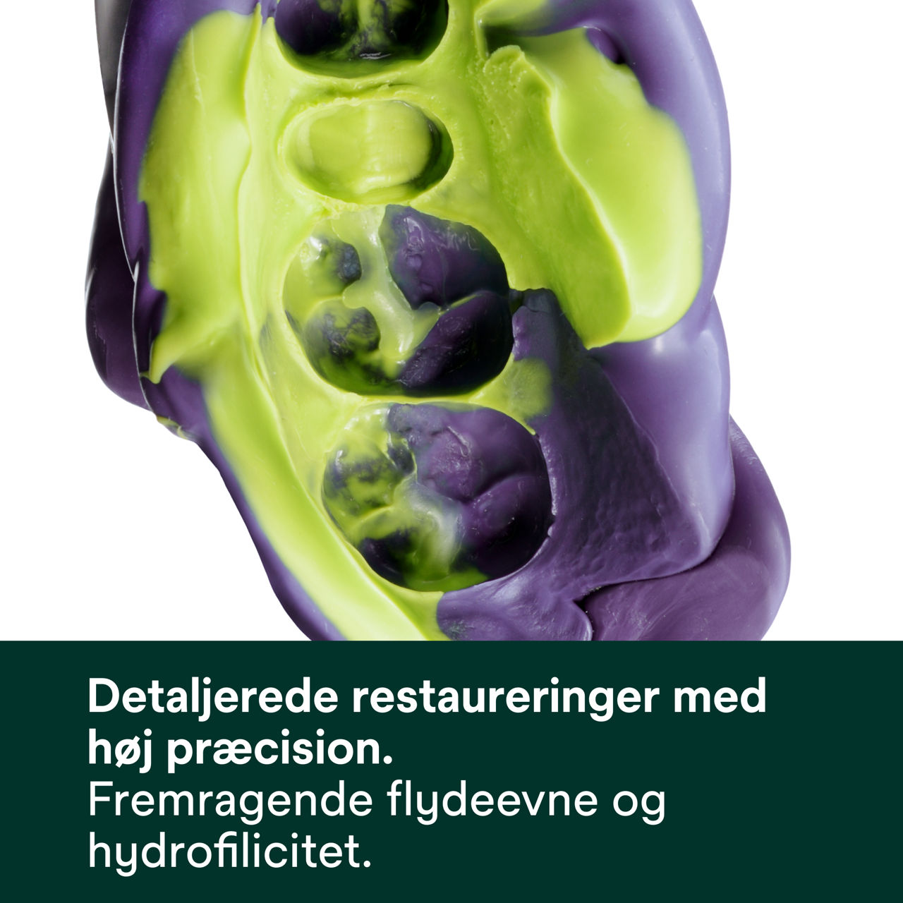 (3) Impregum™ Super Quick polyæteraftryksmateriale: Detaljerede restaureringer med høj præcision.