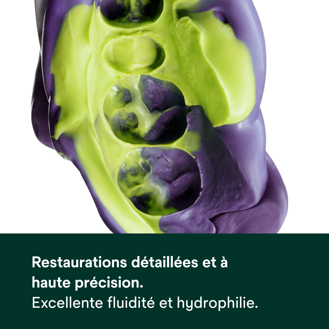 (3) Matériau d'empreinte polyéther Impregum™ Super Quick: Restaurations détaillées