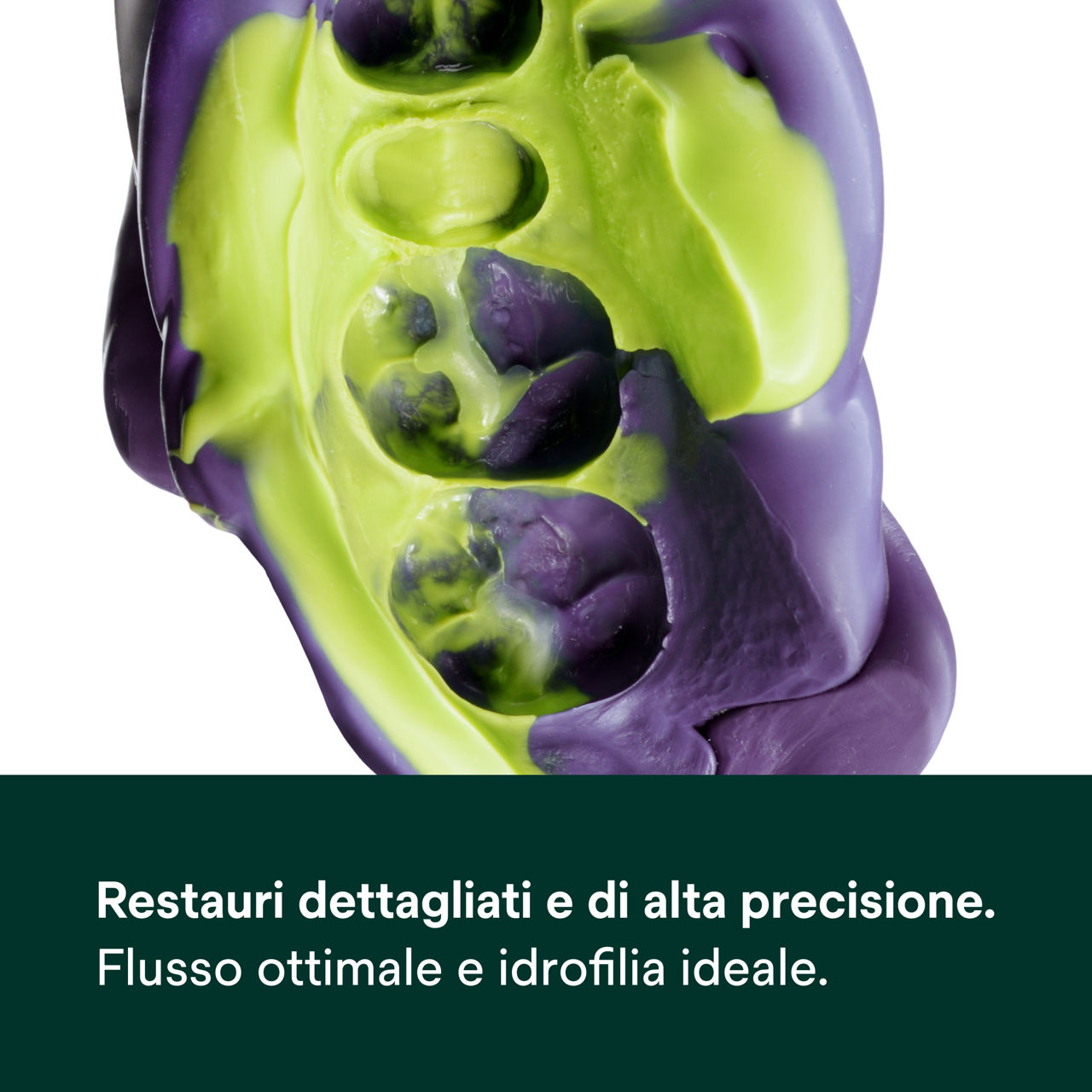 (3) Materiale per impronte in polietere Impregum™ Super Quick: Restauri dettagliati