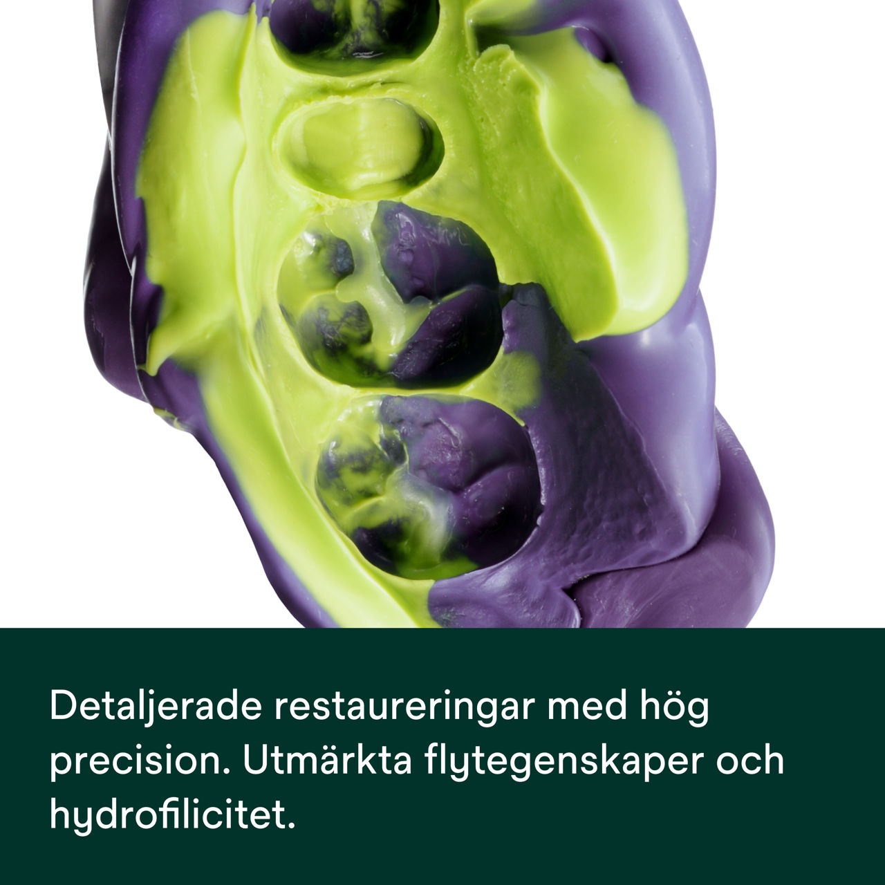 (3) Impregum™ Super Quick polyeter avtrycksmaterial: Detaljerade restaureringar