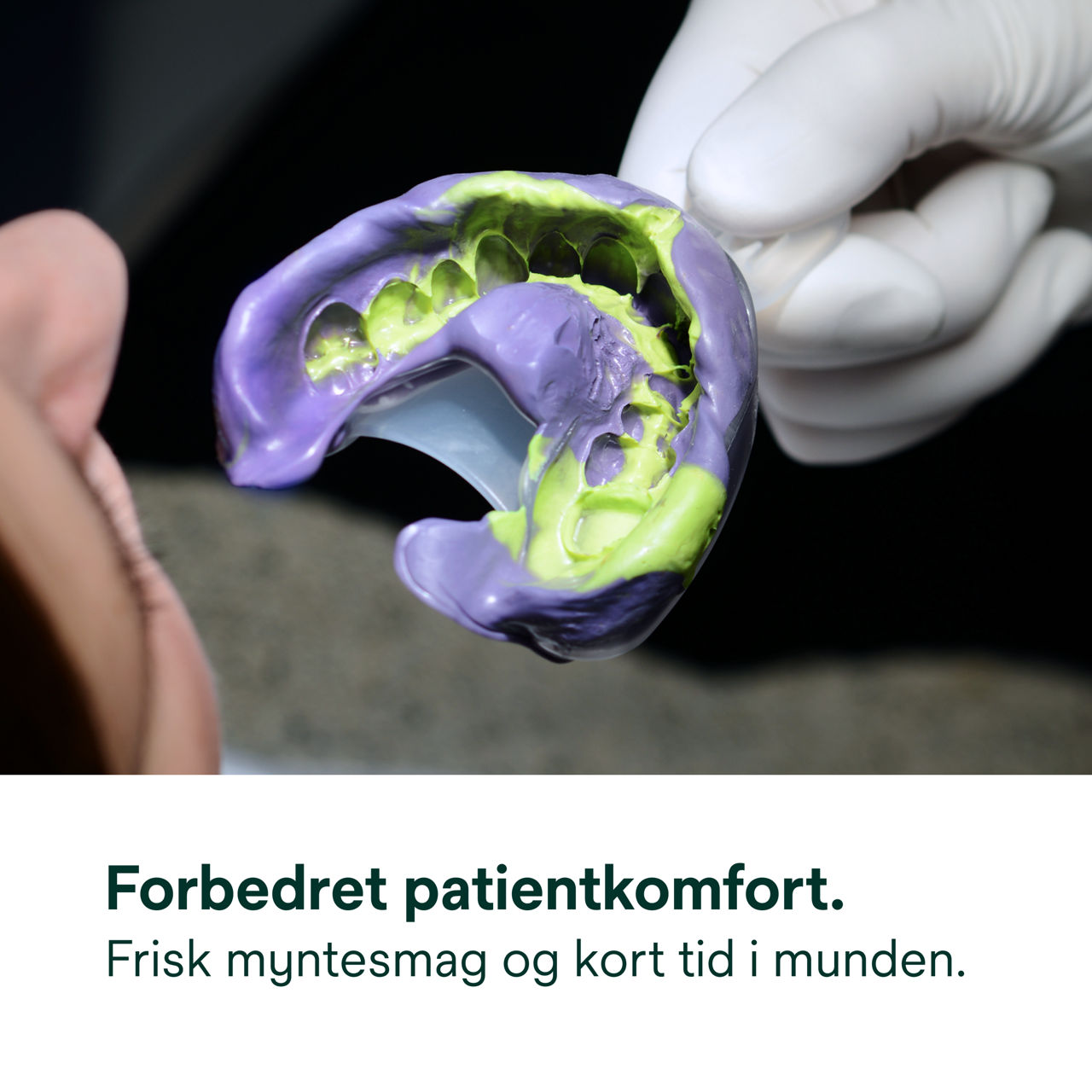(4) Impregum™ Super Quick polyæteraftryksmateriale: Forbedret patientkomfort.