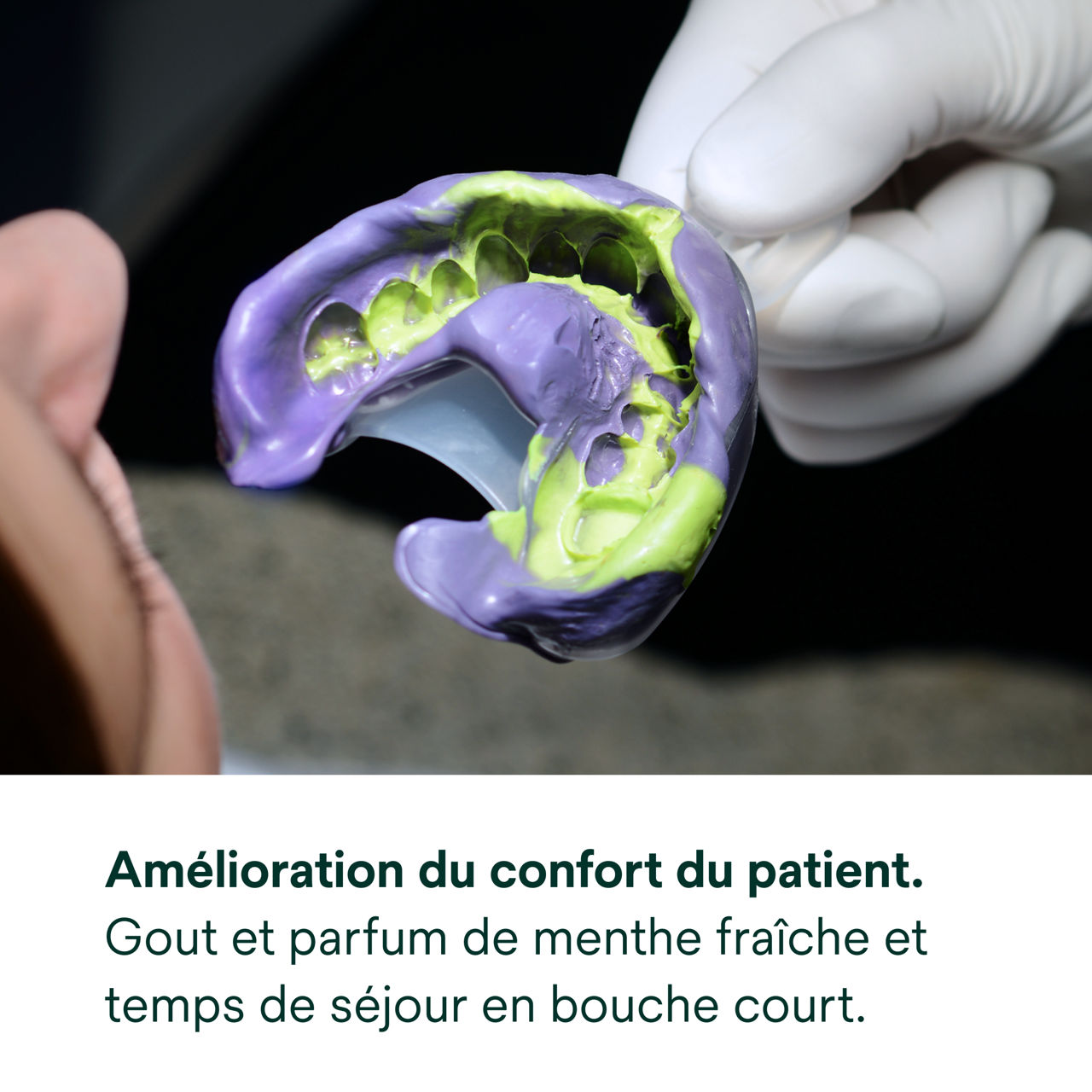(4) Matériau d'empreinte polyéther Impregum™ Super Quick: Amélioration du confort du patient.