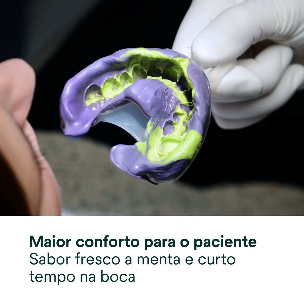 (4)  Material de Impressão de Poliéter Impregum™ Super Quick: Maior conforto para o paciente