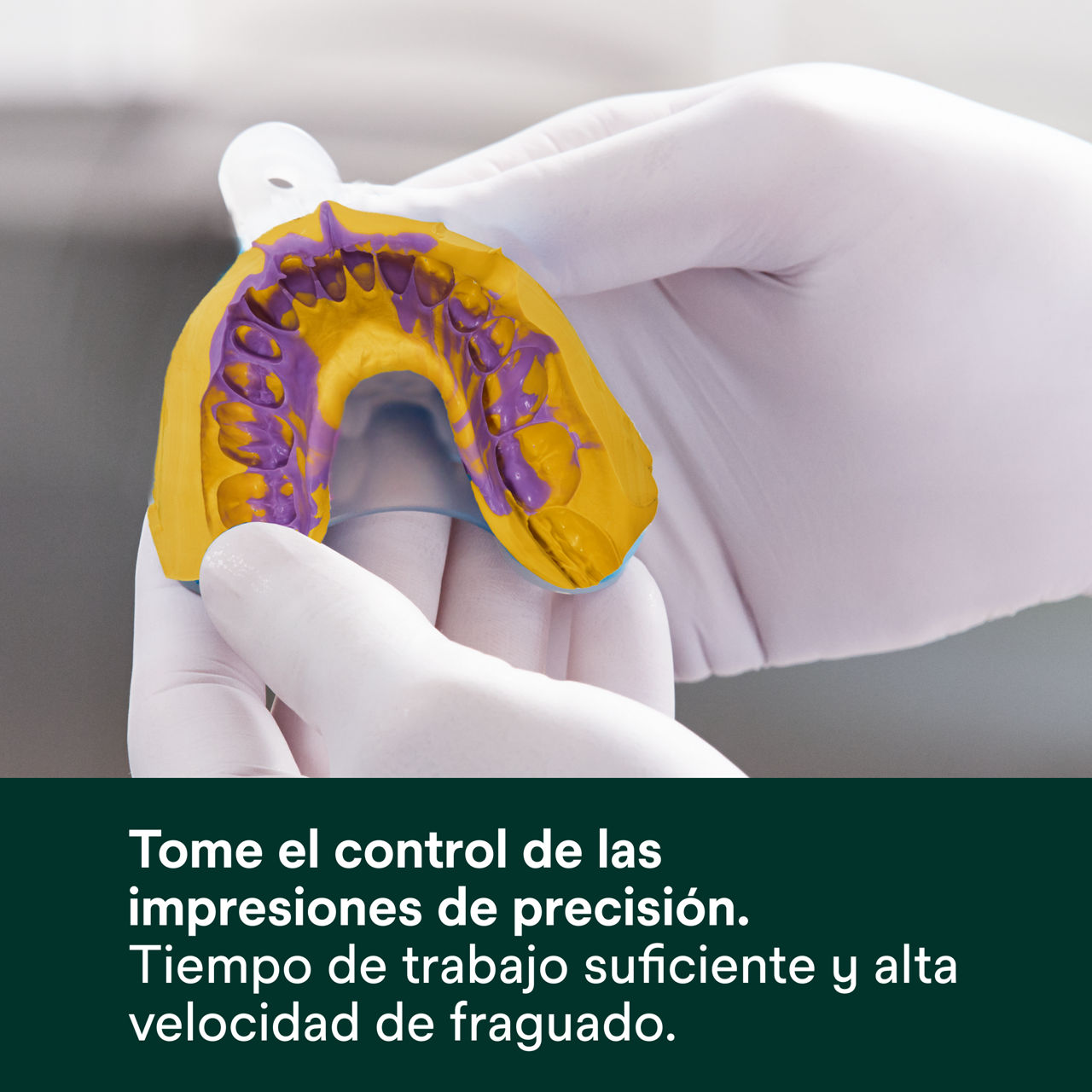 (2 - Quick) Imprint 4 VPS: Tome el control de las impresiones de precisión