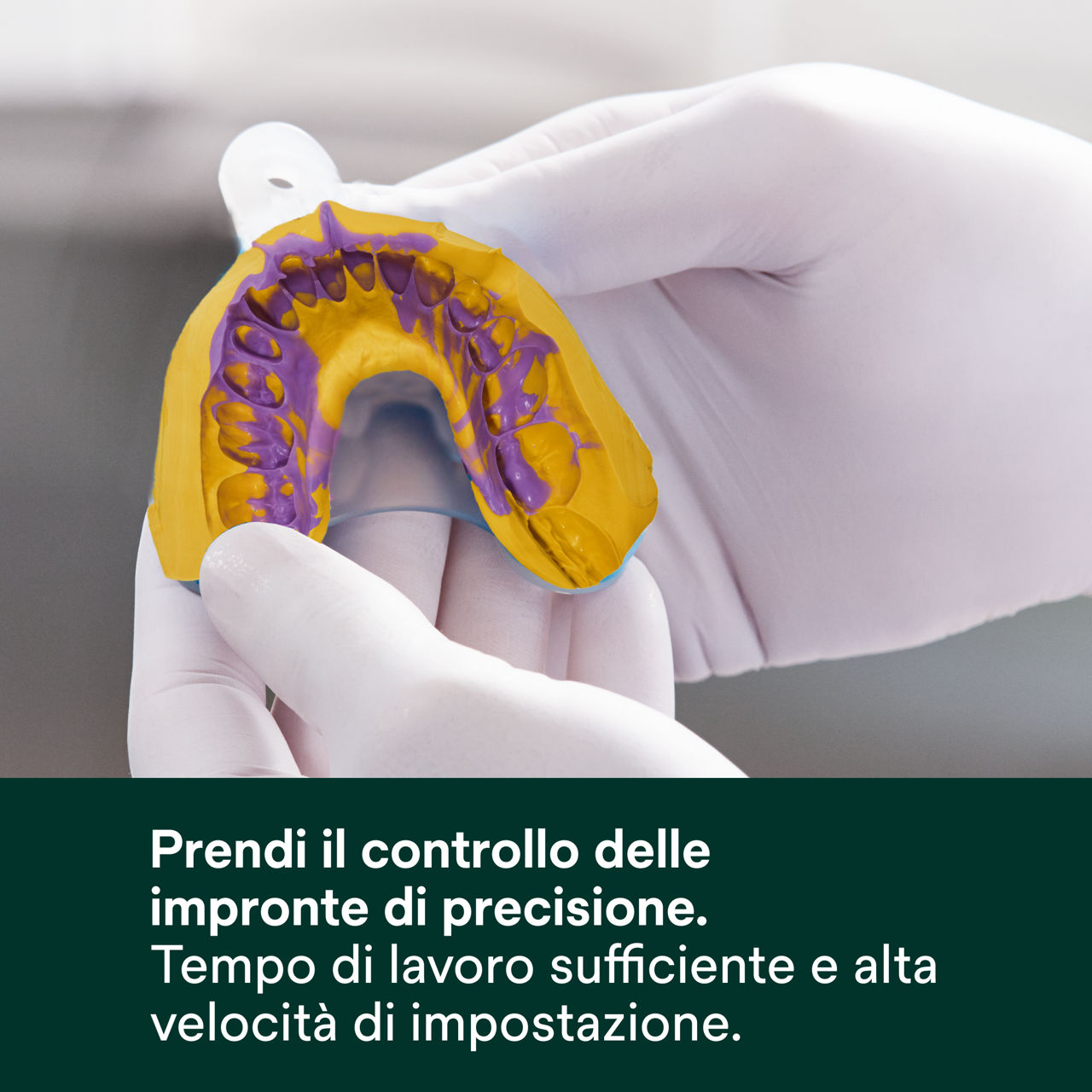 (2 - Quick) Imprint 4 VPS: Prendi il controllo delle impronte di precisione.