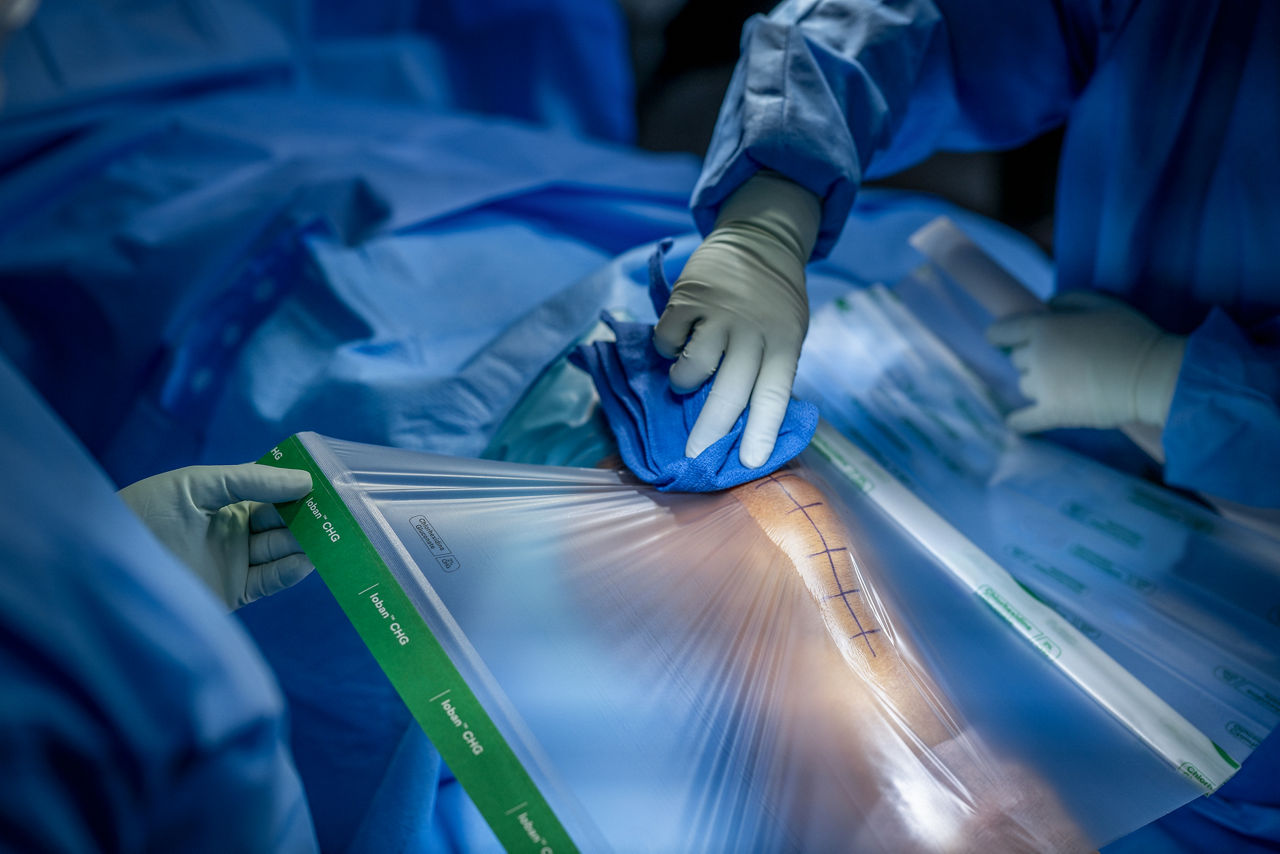 3M™ Ioban™ CHG Chlorhexidine Gluconate Incise Drape (contains 2% w/w CHG)