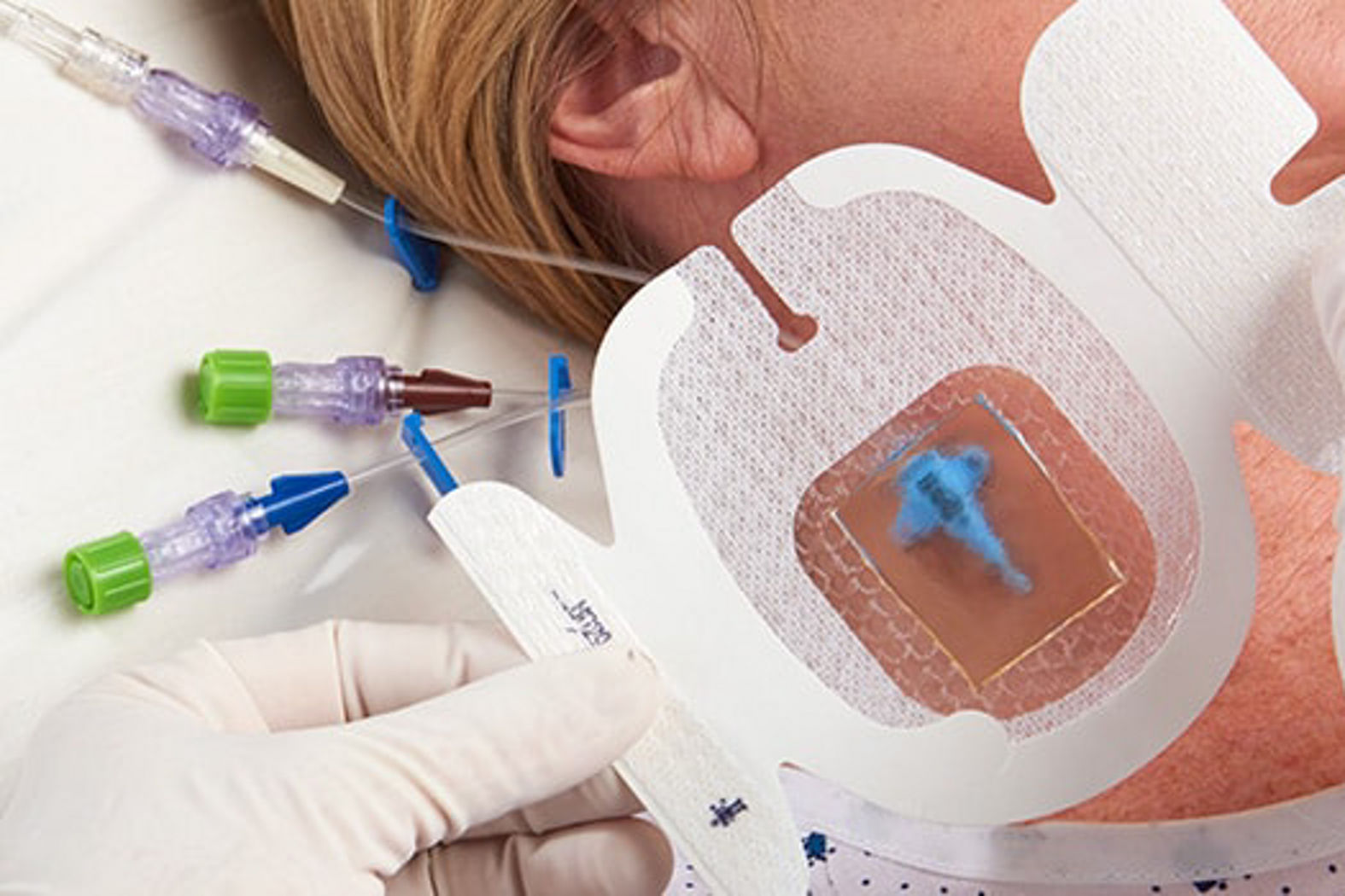 IV site management
