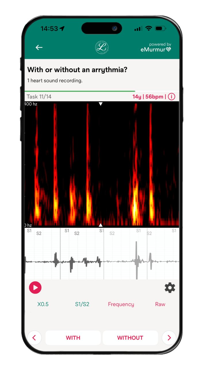 Mobile app screen showing a heart sound arrhythmia identification task with phonocardiogram waveform; S1 and S2 markers; patient aged 14 at 56 bpm. User selects with or without arrhythmia.