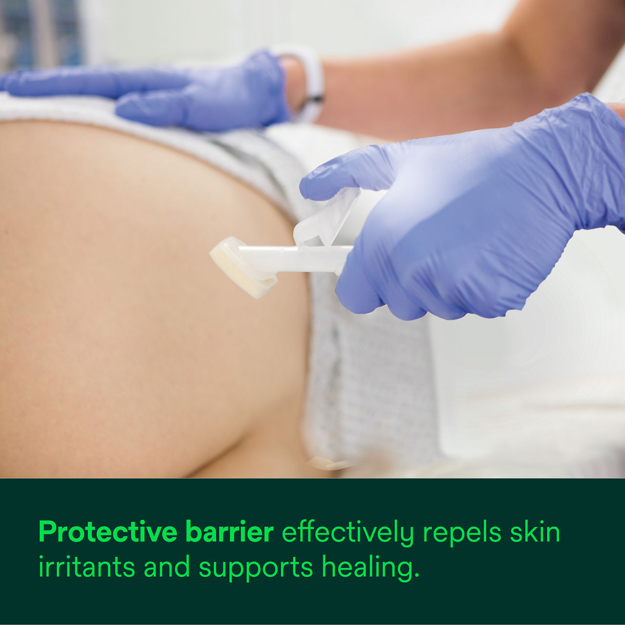 Cavilon Advanced Skin Protectant: Protective barrier effectively repels skin irritants