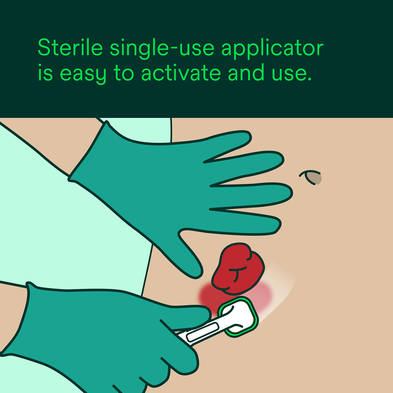 Cavilon Advanced Skin Protectant: Sterile single-use applicator is easy to activate and use