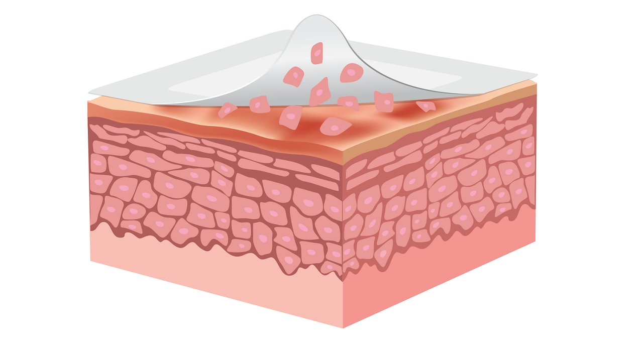 Secondary Image 2 for use on Cavilon No Sting Barrier Film PDPs featuring skin layer protection image and protects skin against MARSI during dressing or tape removal text