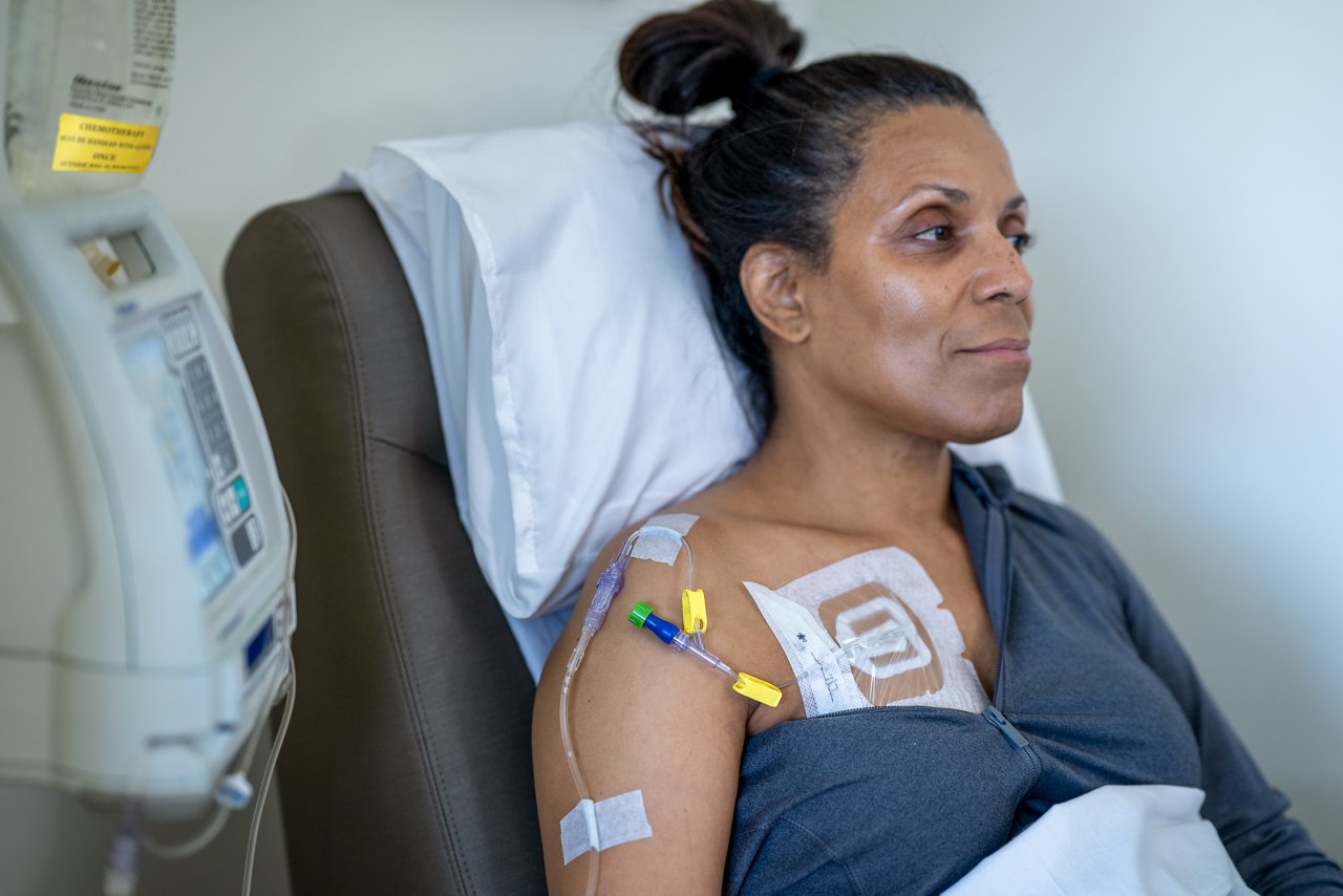 ผู้ป่วยมะเร็งวิทยาที่มี Tegaderm 1665 ปิดทับที่พอร์ตและผู้ป่วยมองไปข้างหน้า