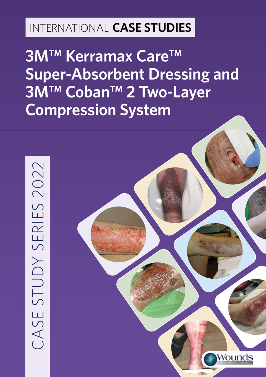 Showcasing Kerramax Care Dressings and Coban 2 Compression System in action