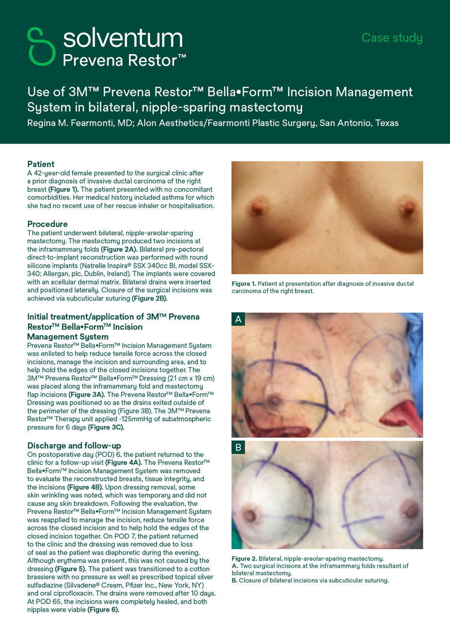Prévia da capa do estudo de caso de mastectomia com o sistema de gerenciamento de incisões Prevena Restor BellaForm