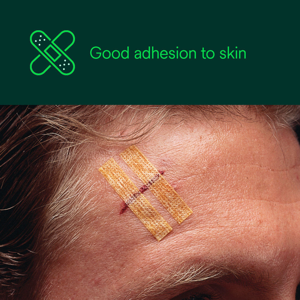 Steri-Strip Antimicrobial Skin Closure – Good Adhesion to Skin