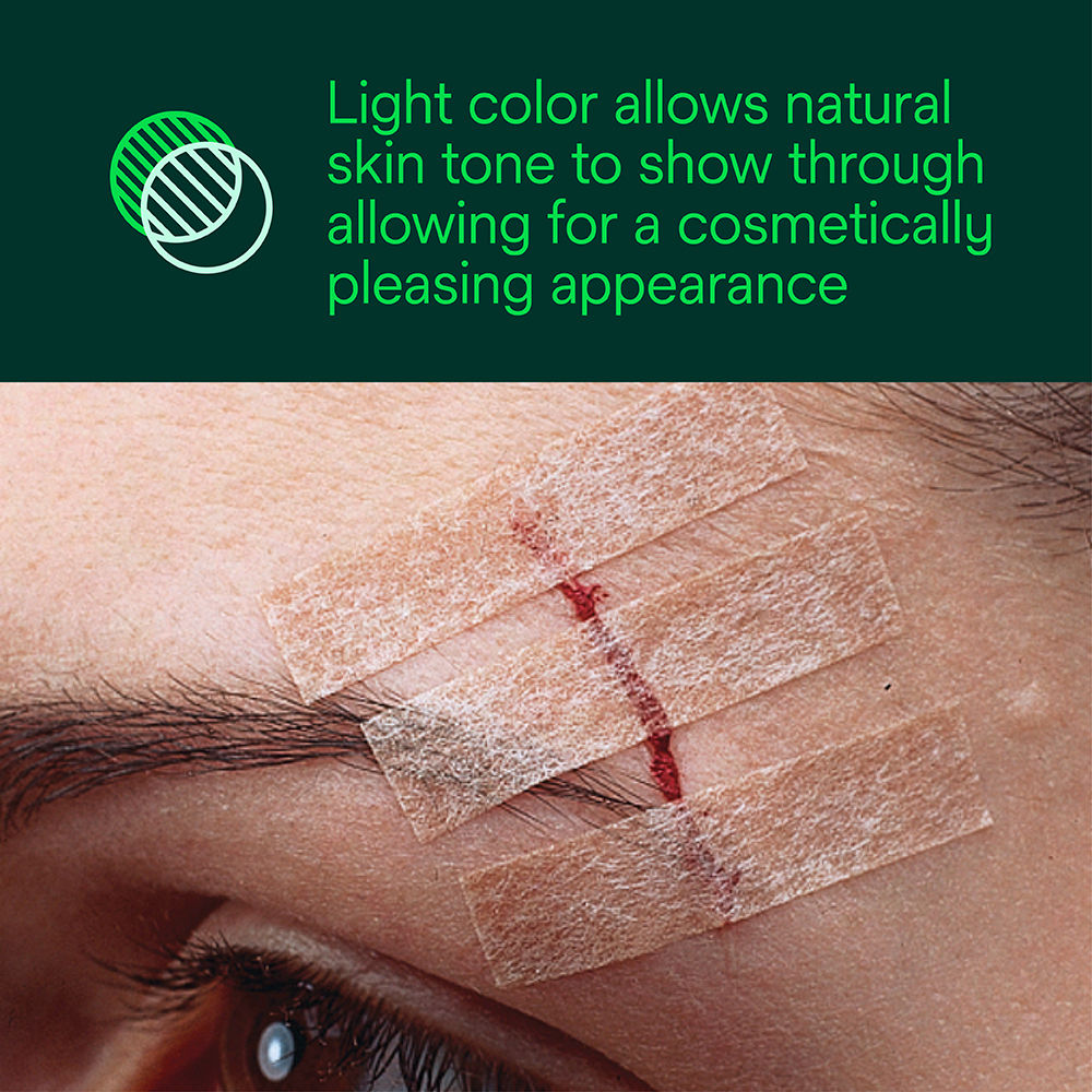 Steri-Strip Blend Tone Skin Closure – Light Color for Cosmetic Appearance