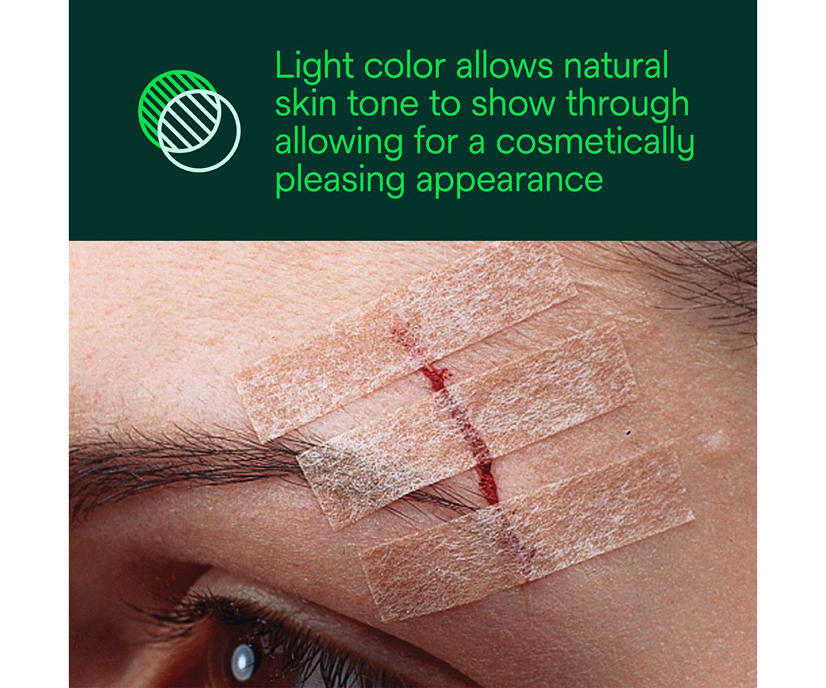 Steri-Strip Blend Tone Skin Closures, Light Beige