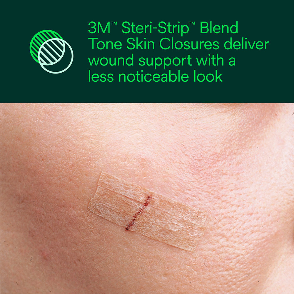 Steri-Strip Blend Tone Skin Closure – Less Noticeable Appearance