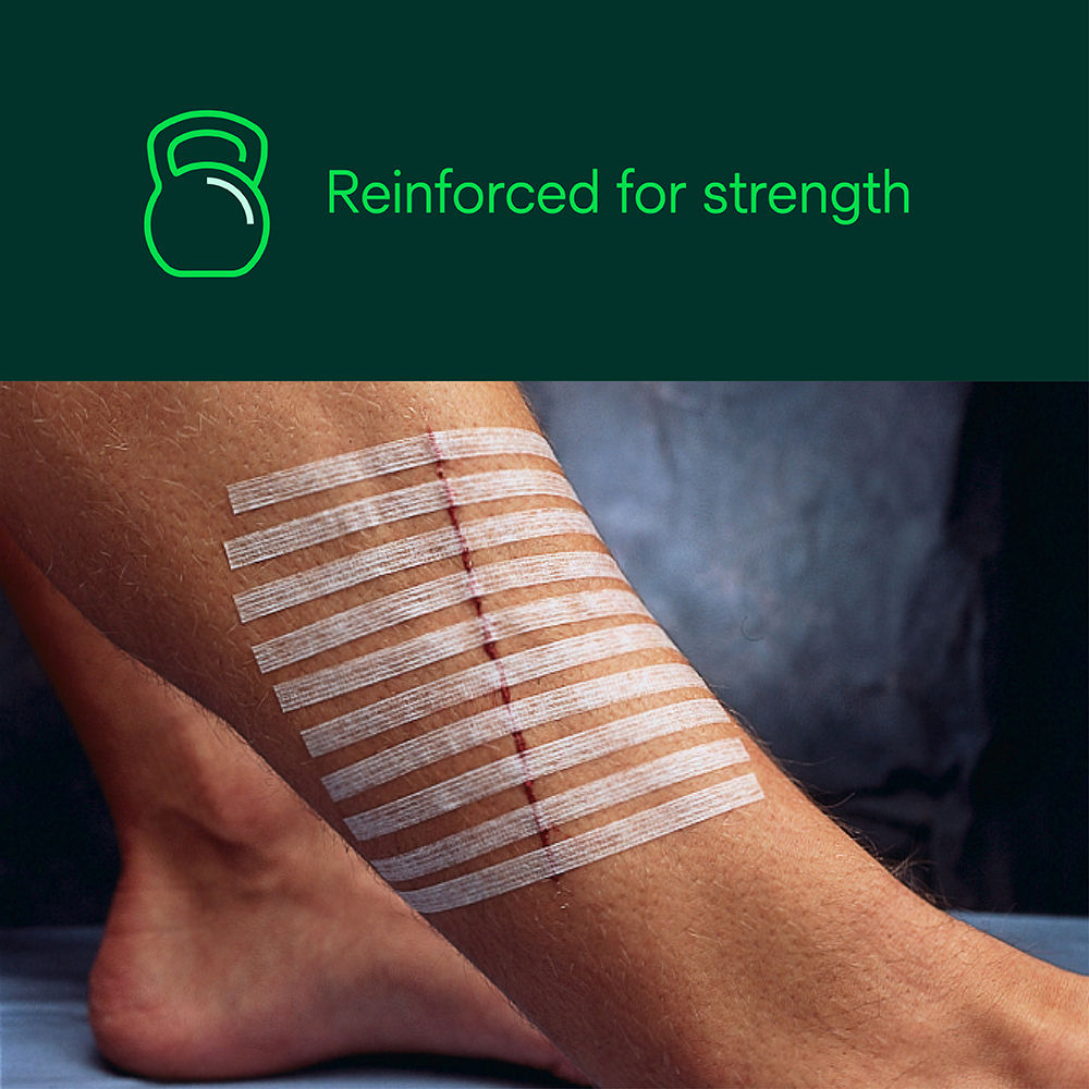 Steri-Strip Reinforced Skin Closure – Strength and Durability