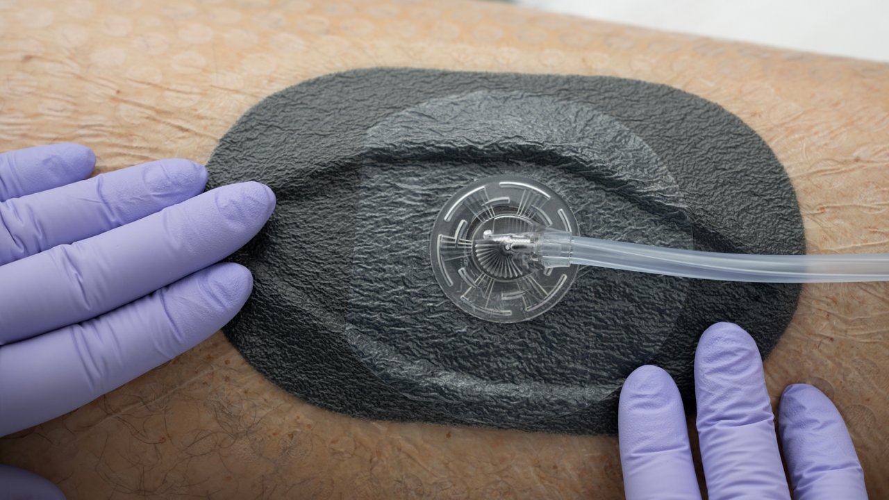 Beauty shot of 3M™ V.A.C.® Peel and Place Dressing and 3M™ SensaT.R.A.C.™ Pad on patient in hospital room with gloved hands smoothing dressing. Product Application Image, rgb, jpg