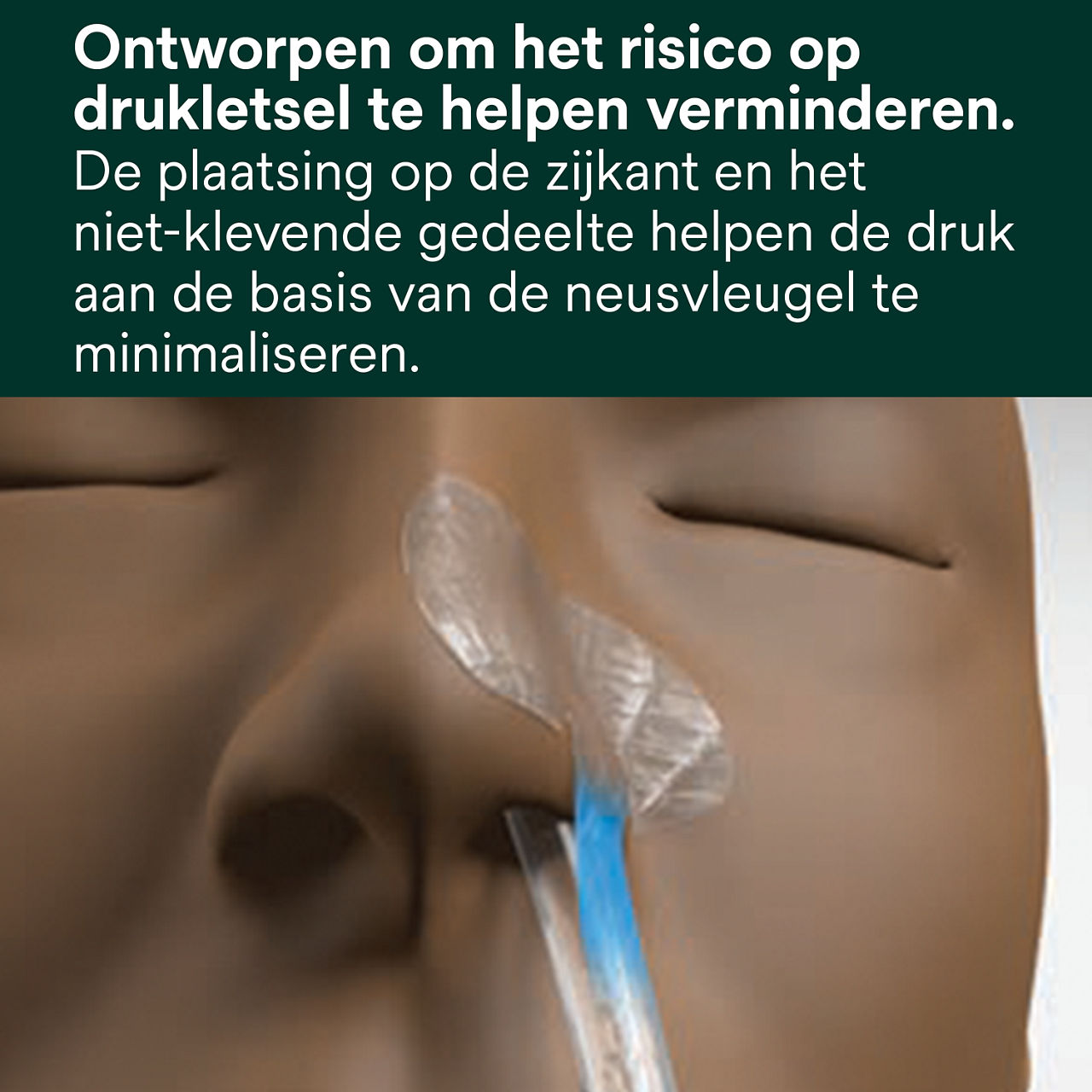 (1) Nasogastrische Fixatieoplossing: Ontworpen om het risico op drukletsel te verminderen