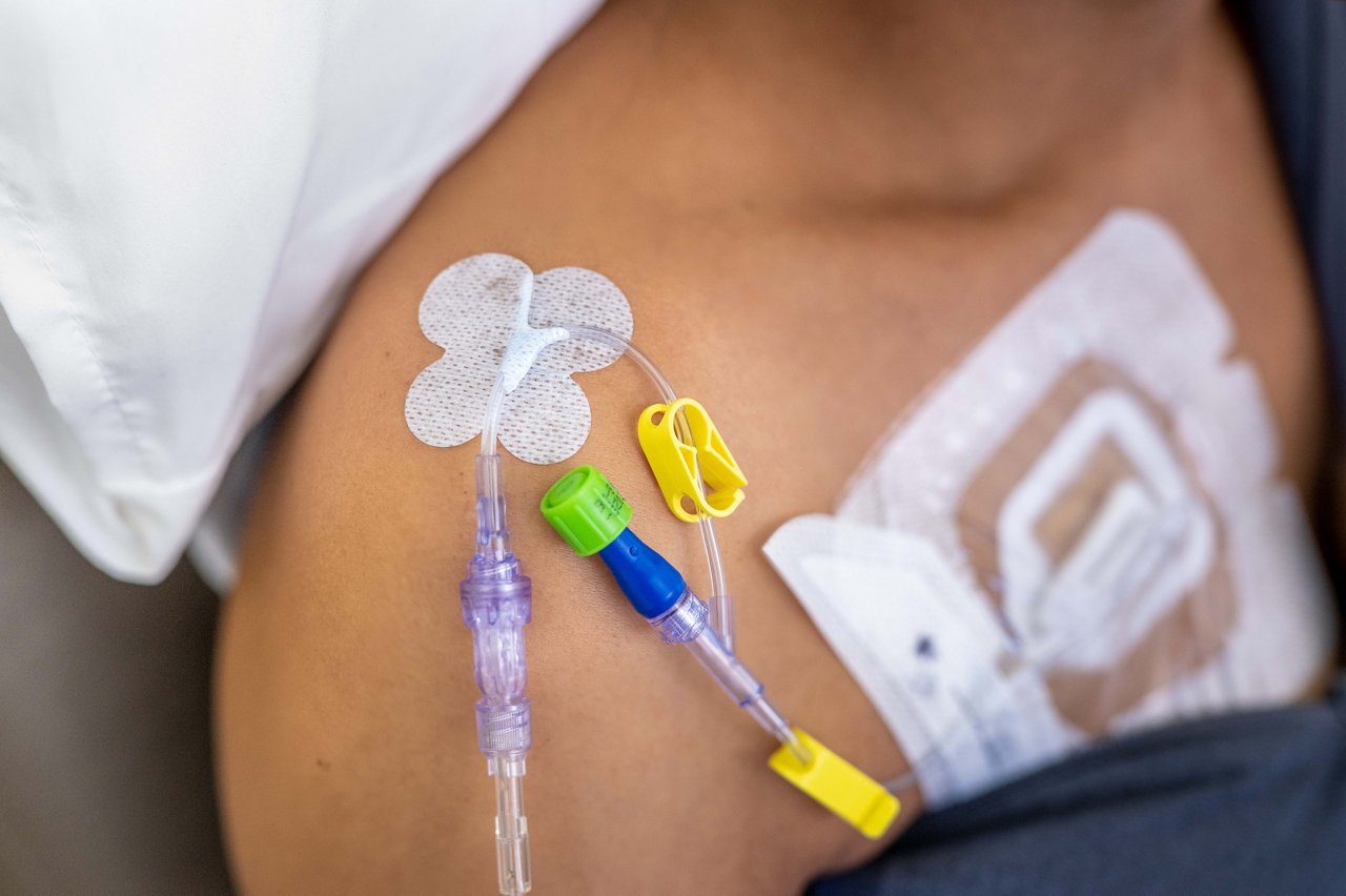 Configuração de Oncologia 8708 UTI