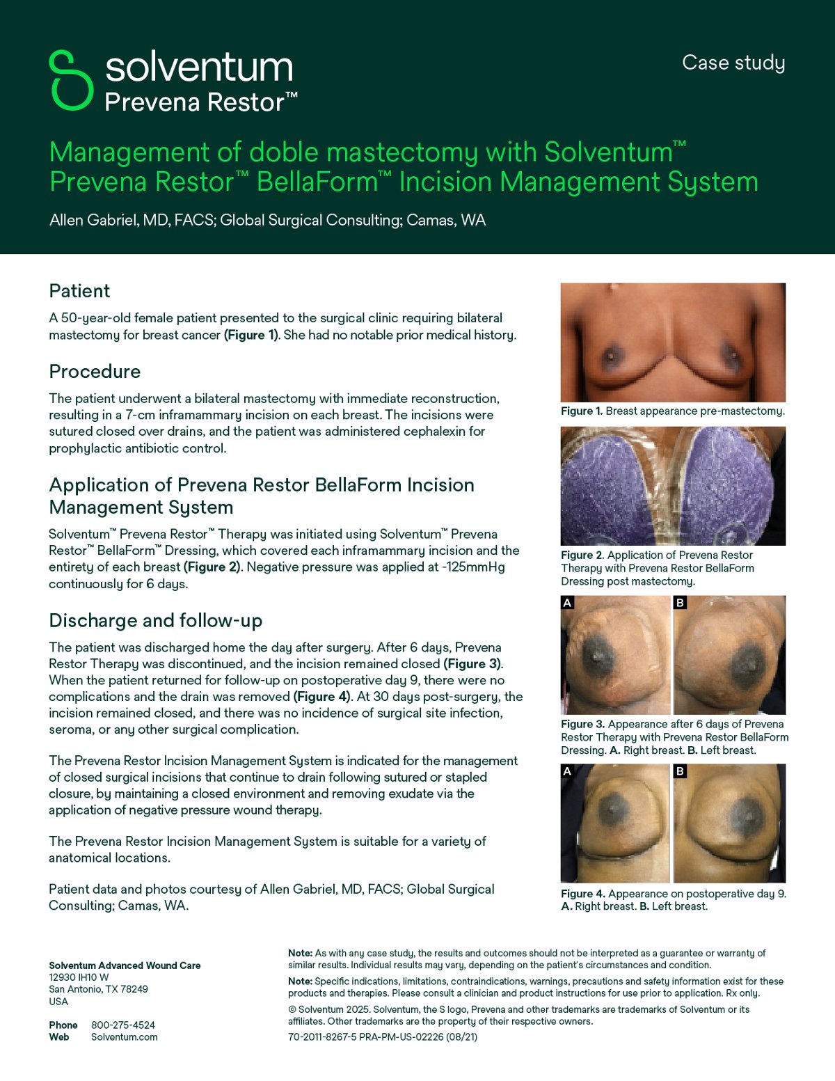 3M Prevena Restor Bella-Form Incision Management System