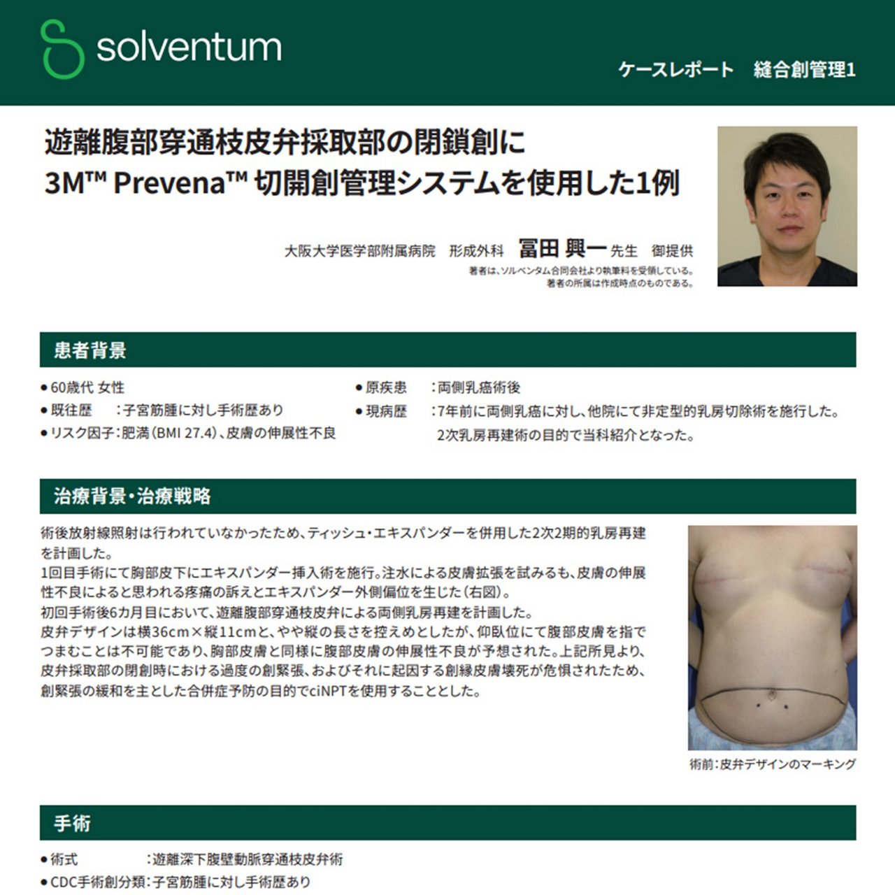 大阪大学医学部附属病院形成外科 冨田興一先生にご執筆いただいたciNPTに関するケースレポートのイメージ画像です。