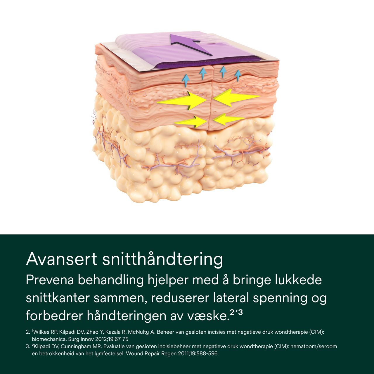 Prevena Peel and Place-systeem - PDP-afbeelding 1