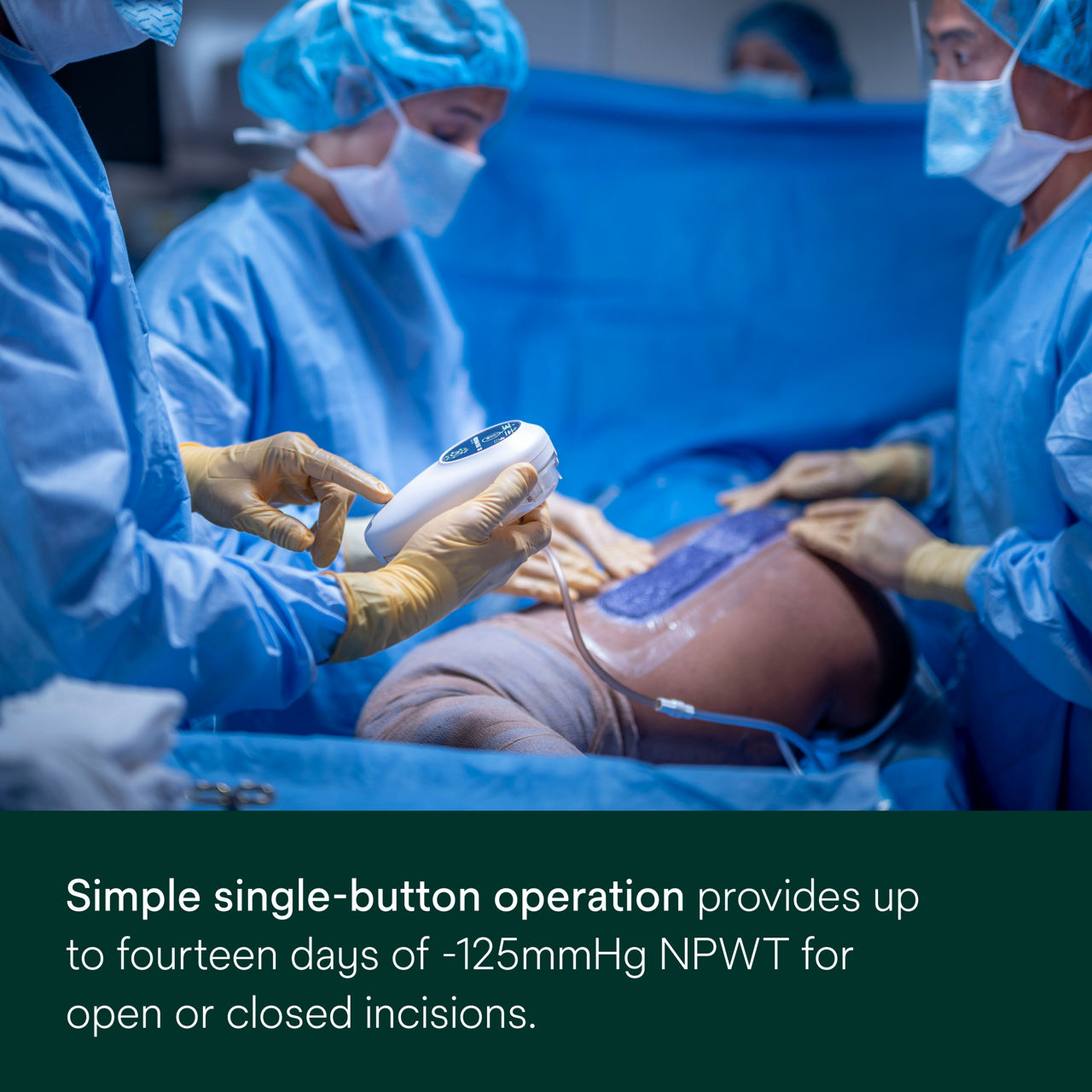 Prevena Plus 125 Unit - PDP Image 3