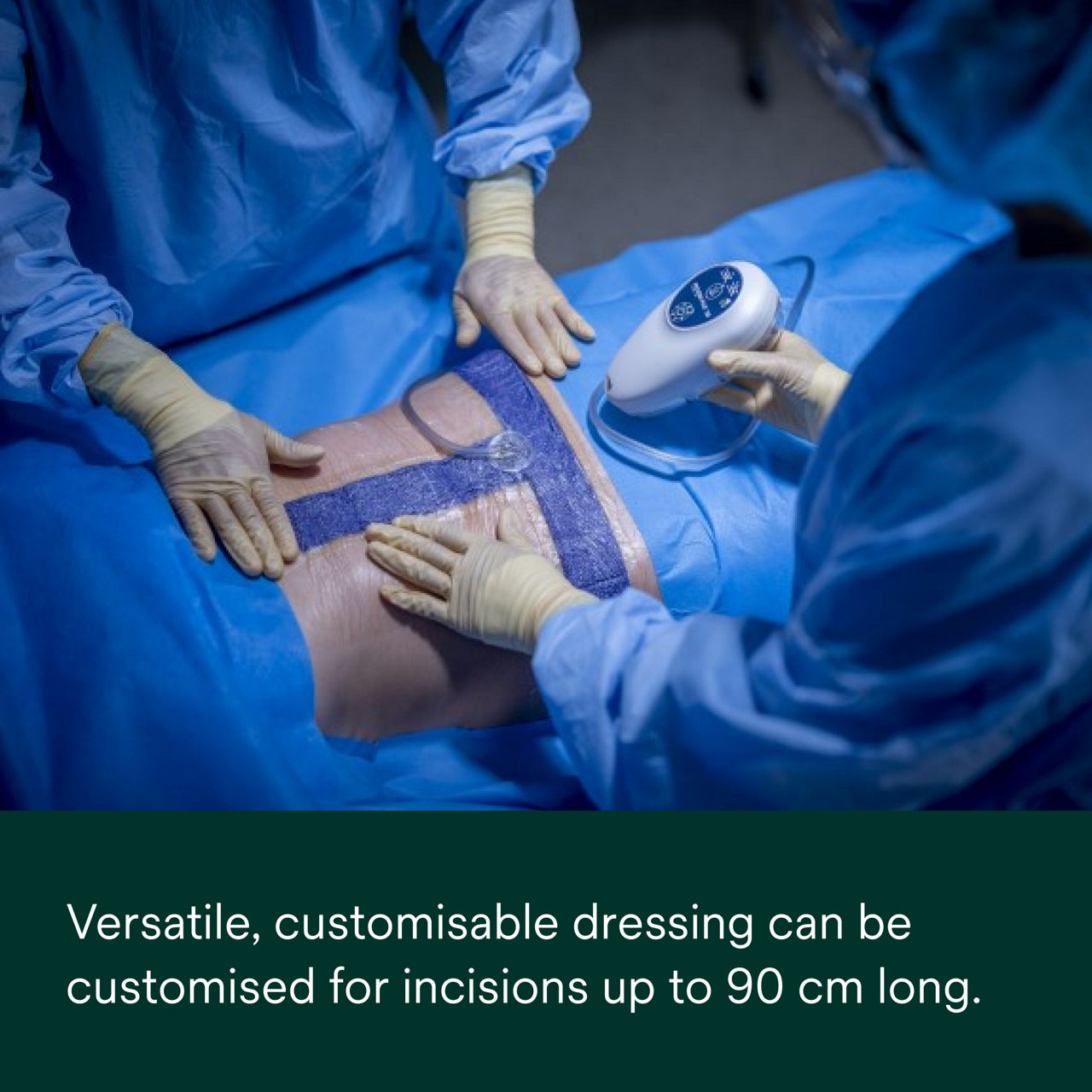 Prevena Plus Customizable Kit - PDP Image 2