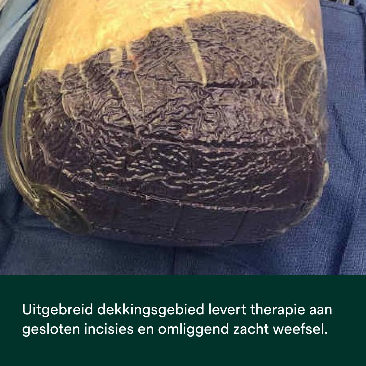 Prevena Restor Bella Form-verband - PDP-afbeelding 5