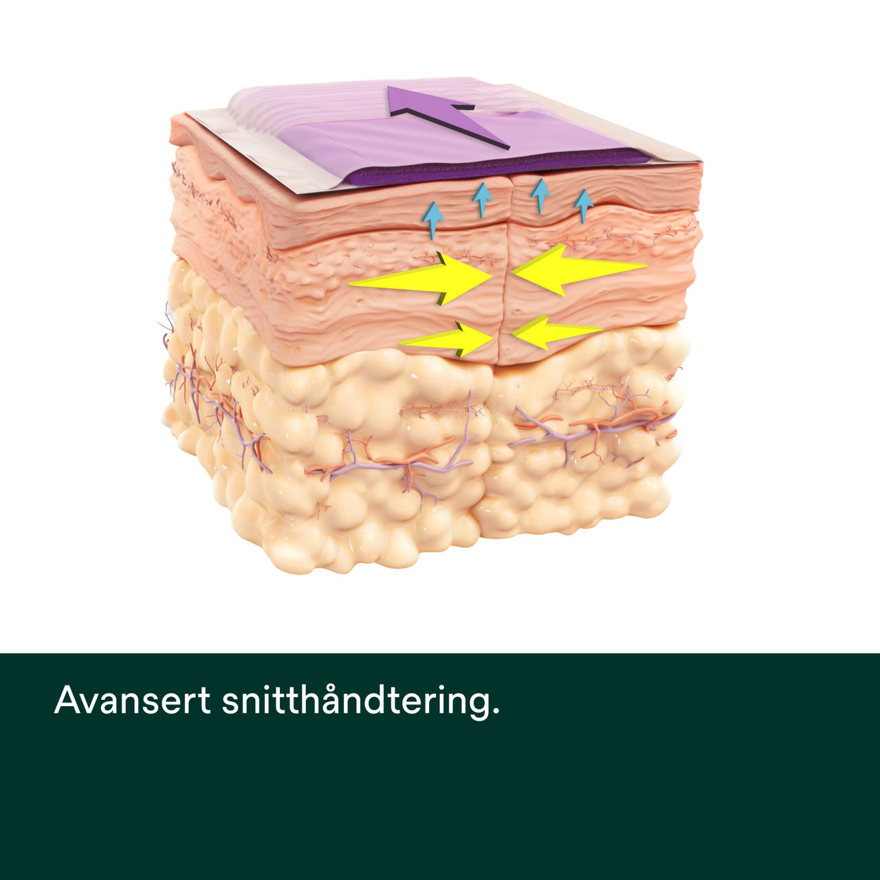 Prevena Restor Bella Form-systeem - PDP-afbeelding 4