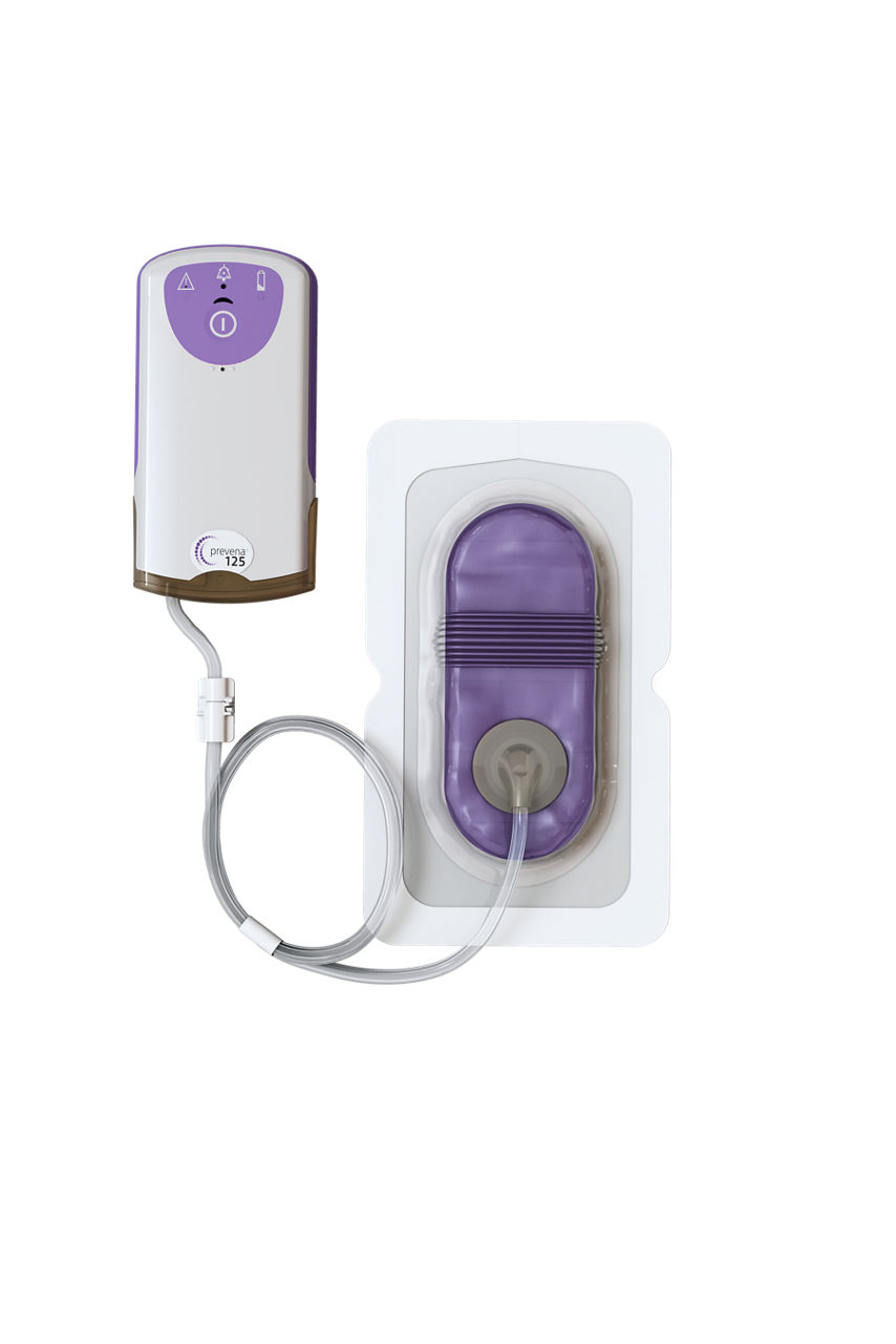 PREVENA PEEL & PLACE™ System Kit, PRE1101US, 13 cm 7 day pump, 1/ea