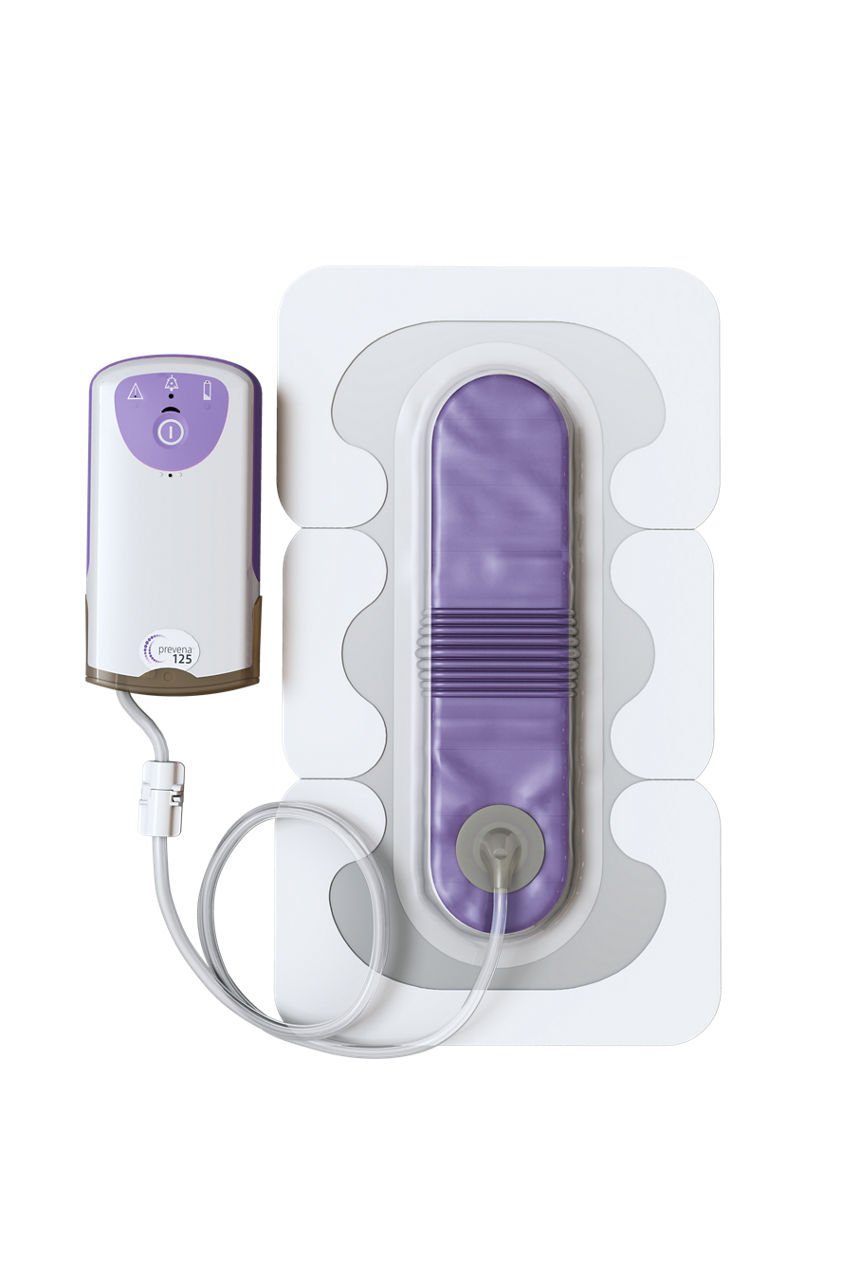 Prevena™ Peel and Place System Kit, PRE1101, 13 cm 7 day pump, 1 Kit
