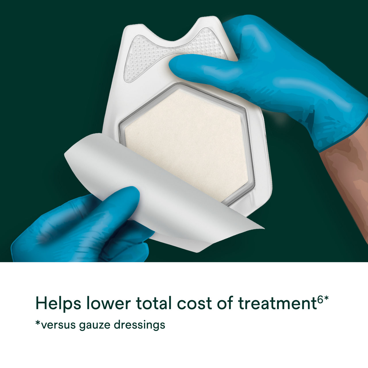 Promogran Prisma Collagen Matrix with Orc and Silver PDP Secondary Image 3