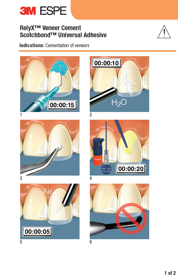RelyX Veneer and Scotchbond Universal Technique Guide
