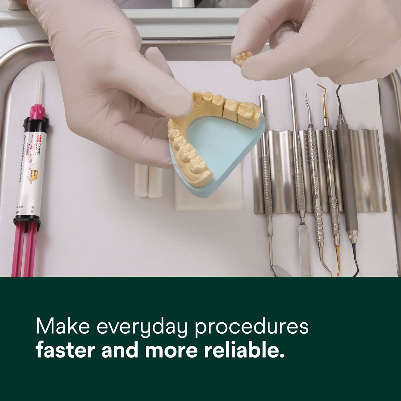 (2) RelyX Luting Plus RMGI Cement: Make everyday procedures faster and more reliable