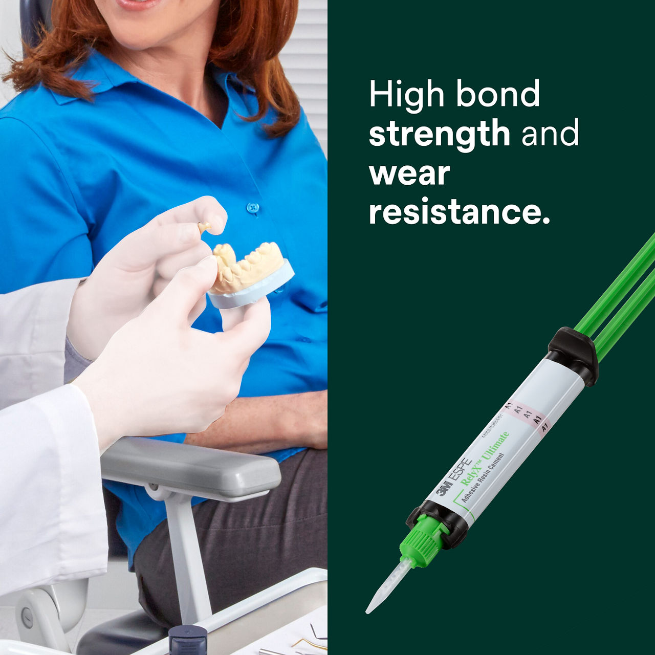 (1) RelyX Ultimate Adhesive Resin Cement: High bond strength and wear resistance