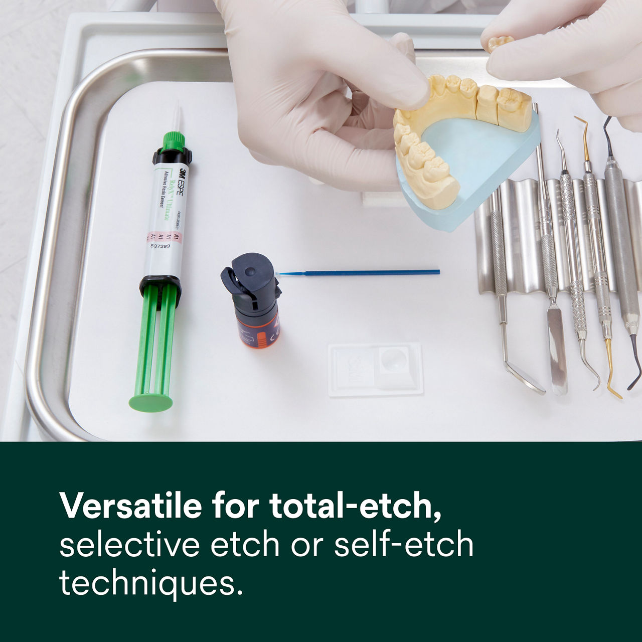 (3 - Syringe) RelyX Ultimate Adhesive Resin Cement: Total-etch, selective-etch or self-etch