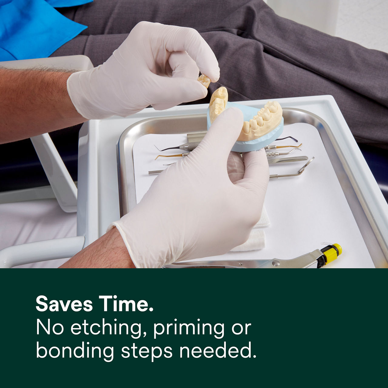 (1) RelyX Unicem Self-Adhesive Resin Cement: Saves time. No etching, priming or bonding steps needed